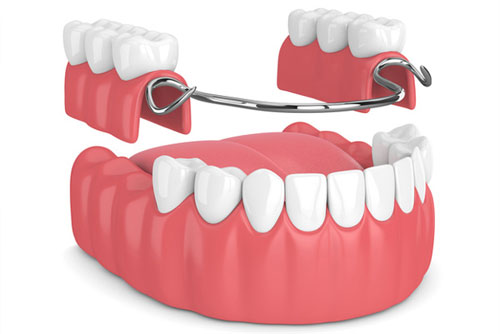 Dentures dental treatment