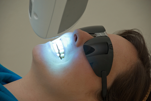 Professional teeth whitening treatment
